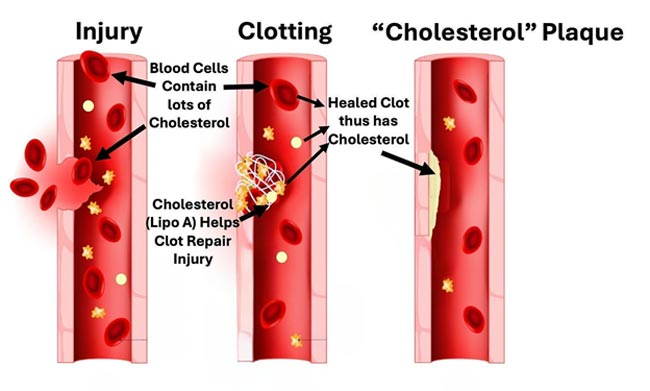 clesterol-dr. Mercola